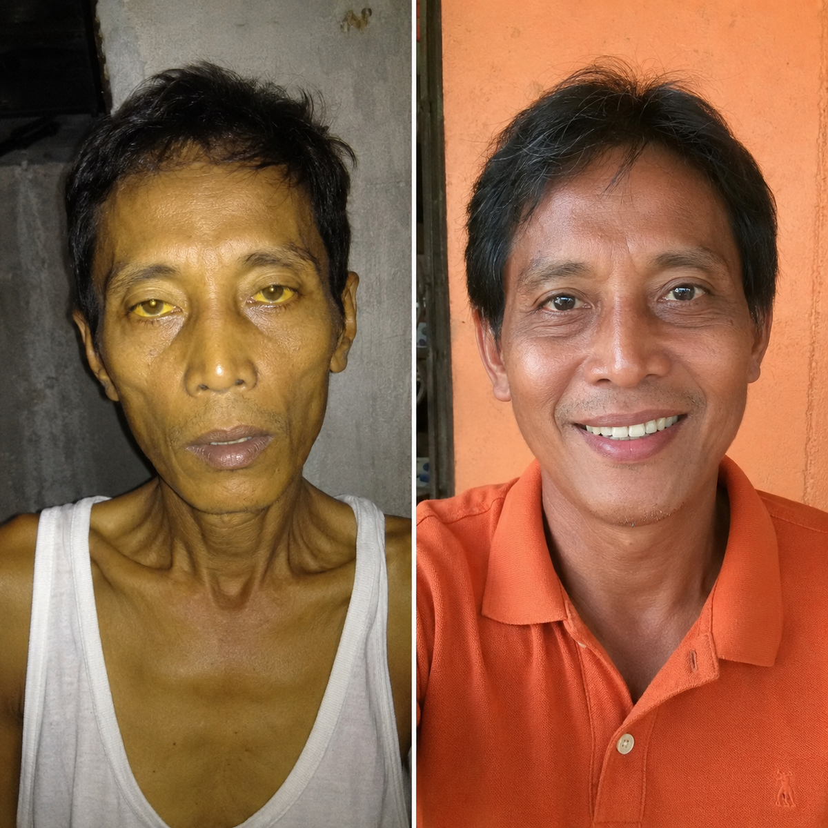 Before and after results