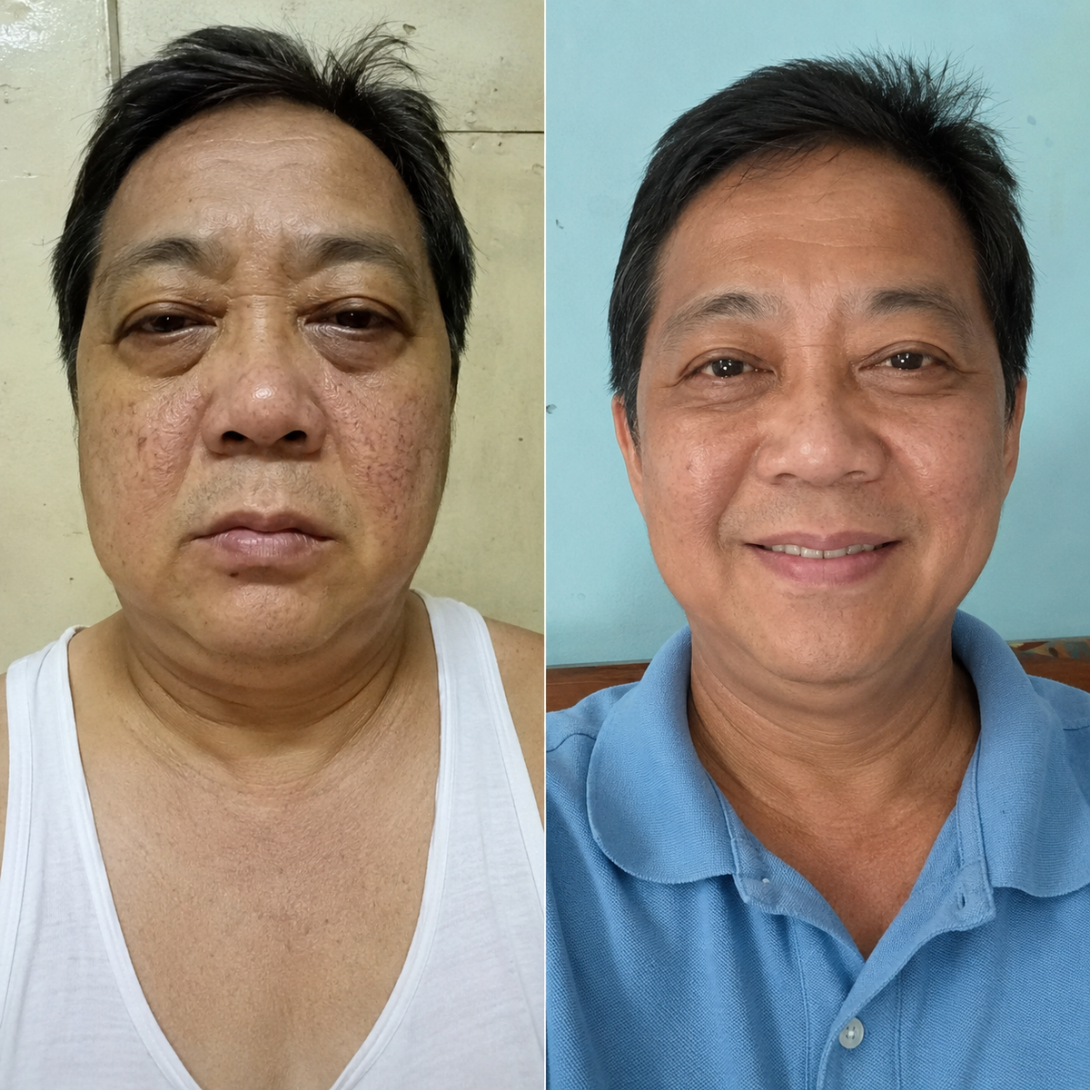Before and after results